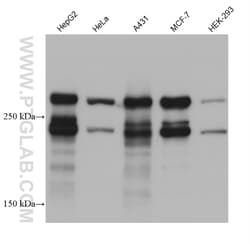 DSP Mouse Monoclonal Antibody, Proteintech Unconjugated; 150 &mu;L:Anticorps,