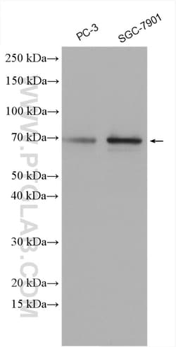 DUB3 Rabbit Polyclonal Antibody, Proteintech Unconjugated; 150 &mu;L:Antibodies,