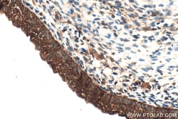 DUSP12 Rabbit Polyclonal Antibody, Proteintech:Antibodies:Primary Antibodies