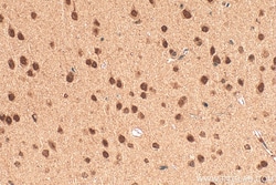 DUSP12 Rabbit Polyclonal Antibody, Proteintech:Antibodies:Primary Antibodies