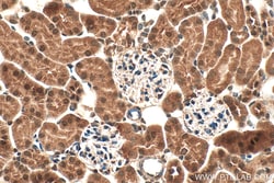 DUSP12 Rabbit Polyclonal Antibody, Proteintech:Antibodies:Primary Antibodies