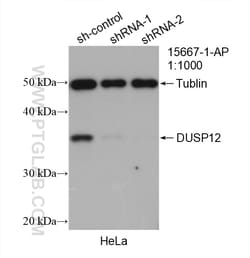 DUSP12 Rabbit Polyclonal Antibody, Proteintech:Antibodies:Primary Antibodies