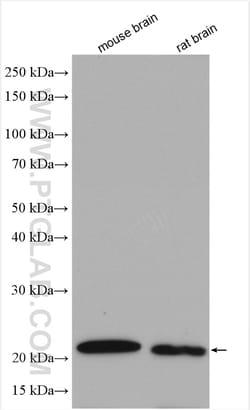 DUSP3 Rabbit Polyclonal Antibody, Proteintech Unconjugated; 20 &mu;L:Antibodies,