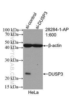 DUSP3 Rabbit Polyclonal Antibody, Proteintech Unconjugated; 20 &mu;L:Antibodies,
