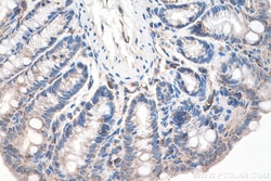 DVL1 Mouse Monoclonal Antibody, Proteintech Unconjugated; 150 &mu;L:Antibodies,