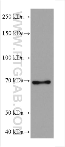 DVL1 Mouse Monoclonal Antibody, Proteintech Unconjugated; 150 &mu;L:Antibodies,
