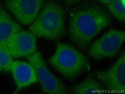 CoraLite Plus 488-conjugated DYNC1H1 Rabbit Polyclonal Antibody, Proteintech:Antibodies:Primary