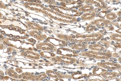 DYNC2H1 Rabbit Polyclonal Antibody, Proteintech Unconjugated; 150 &mu;L:Antibodies,