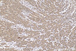 DYNC2H1 Rabbit Polyclonal Antibody, Proteintech Unconjugated; 150 &mu;L:Antibodies,