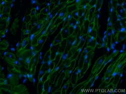 Dystrophin Mouse Monoclonal Antibody, Proteintech Unconjugated; 20 &mu;L:Antibodies,