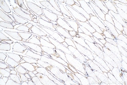 Dystrophin Mouse Monoclonal Antibody, Proteintech Unconjugated; 20 &mu;L:Antibodies,