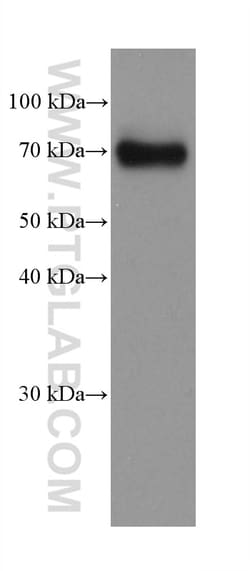 Dystrophin Mouse Monoclonal Antibody, Proteintech Unconjugated; 20 &mu;L:Antibodies,