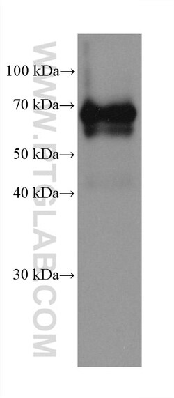 Dystrophin Mouse Monoclonal Antibody, Proteintech Unconjugated; 20 &mu;L:Antibodies,