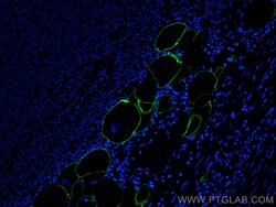 E-selectin / CD62E Rabbit Polyclonal Antibody, Proteintech:Antibodies:Primary