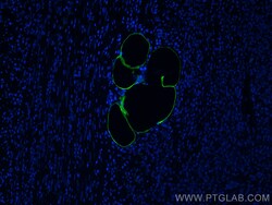 E-selectin / CD62E Rabbit Polyclonal Antibody, Proteintech:Antibodies:Primary
