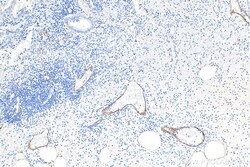 E-selectin / CD62E Rabbit Polyclonal Antibody, Proteintech:Antibodies:Primary