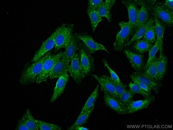 ECH1 Mouse Monoclonal Antibody, Proteintech Unconjugated; 150 &mu;L:Antibodies,