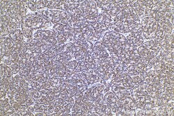 ECH1 Mouse Monoclonal Antibody, Proteintech Unconjugated; 150 &mu;L:Antibodies,