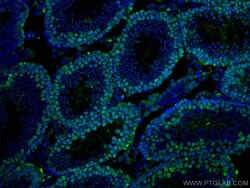 EED Mouse Monoclonal Antibody, Proteintech:Antibodies:Primary Antibodies