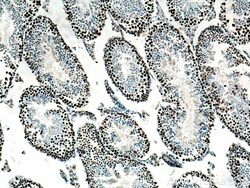 EED Mouse Monoclonal Antibody, Proteintech:Antibodies:Primary Antibodies