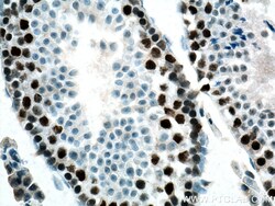 EED Mouse Monoclonal Antibody, Proteintech:Antibodies:Primary Antibodies