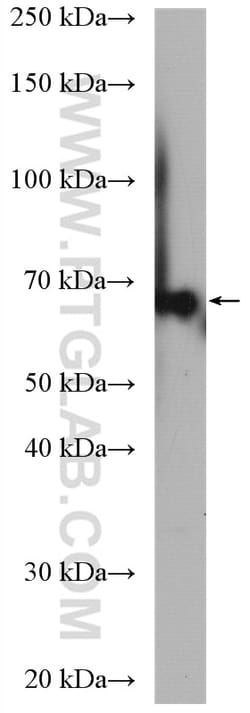 EEFSEC Rabbit Polyclonal Antibody, Proteintech Unconjugated; 20 &mu;L:Antibodies,