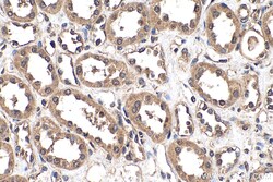 Ephrin B1 Rabbit Polyclonal Antibody, Proteintech Unconjugated; 20 &mu;L:Antibodies,