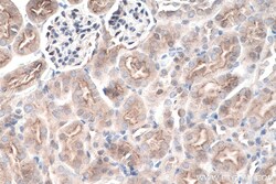 Ephrin B1 Rabbit Polyclonal Antibody, Proteintech Unconjugated; 20 &mu;L:Antibodies,