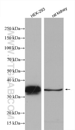 Ephrin B1 Rabbit Polyclonal Antibody, Proteintech Unconjugated; 20 &mu;L:Antibodies,