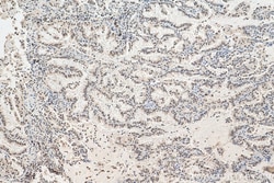 EHMT2 Rabbit Polyclonal Antibody, Proteintech Unconjugated; 20 &mu;L:Antibodies,