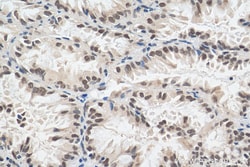 EHMT2 Rabbit Polyclonal Antibody, Proteintech Unconjugated; 20 &mu;L:Antibodies,