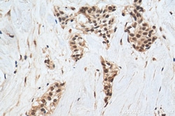 EHMT2 Rabbit Polyclonal Antibody, Proteintech Unconjugated; 20 &mu;L:Antibodies,
