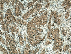 EIF2AK1 Mouse Monoclonal Antibody, Proteintech 20 &mu;L | Buy Online | Proteintech | Fisher Scientific