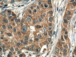 EIF2AK1 Mouse Monoclonal Antibody, Proteintech 20 &mu;L | Buy Online | Proteintech | Fisher Scientific