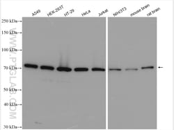 EIF2B5 Rabbit Polyclonal Antibody, Proteintech Unconjugated; 150 &mu;L:Antibodies,