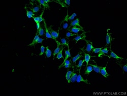 EIF4A2 Mouse Monoclonal Antibody, Proteintech Unconjugated; 20 &mu;L:Antibodies,