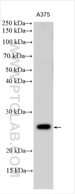ELA1 Rabbit Polyclonal Antibody, Proteintech Unconjugated; 20 &mu;L:Antibodies,