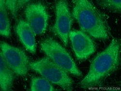 ENO1/2/3 Rabbit Recombinant Antibody, Proteintech Unconjugated; 20 &mu;L:Antibodies,