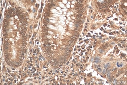 ENO1/2/3 Rabbit Recombinant Antibody, Proteintech Unconjugated; 20 &mu;L:Antibodies,