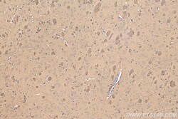 ENO1/2/3 Rabbit Recombinant Antibody, Proteintech Unconjugated; 20 &mu;L:Antibodies,