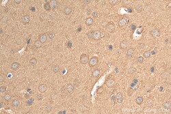 ENO1/2/3 Rabbit Recombinant Antibody, Proteintech Unconjugated; 20 &mu;L:Antibodies,