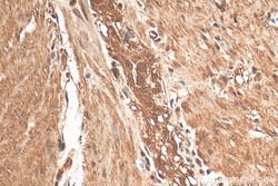 ENO1/2/3 Rabbit Recombinant Antibody, Proteintech Unconjugated; 20 &mu;L:Antibodies,