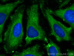 ENO3 Mouse Monoclonal Antibody, Proteintech:Antibodies:Primary Antibodies