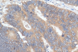 ENT1 Rabbit Polyclonal Antibody, Proteintech Unconjugated; 150 &mu;L:Antibodies,