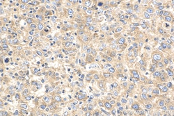 ENT1 Rabbit Polyclonal Antibody, Proteintech Unconjugated; 150 &mu;L:Antibodies,