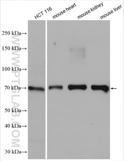 ENT1 Rabbit Polyclonal Antibody, Proteintech Unconjugated; 150 &mu;L:Antibodies,
