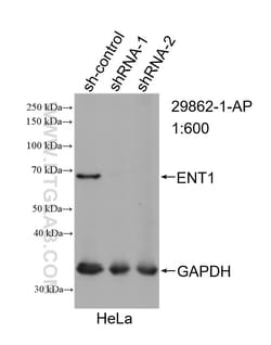 ENT1 Rabbit Polyclonal Antibody, Proteintech Unconjugated; 150 &mu;L:Antibodies,