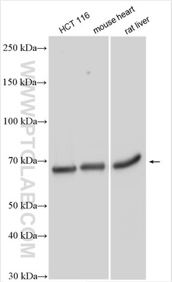 ENT1 Rabbit Polyclonal Antibody, Proteintech Unconjugated; 150 &mu;L:Antibodies,