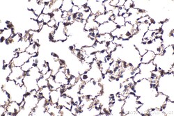 p300 Rabbit Polyclonal Antibody, Proteintech:Antibodies:Primary Antibodies
