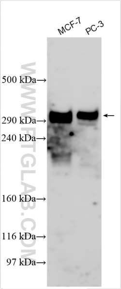 p300 Rabbit Polyclonal Antibody, Proteintech:Antibodies:Primary Antibodies